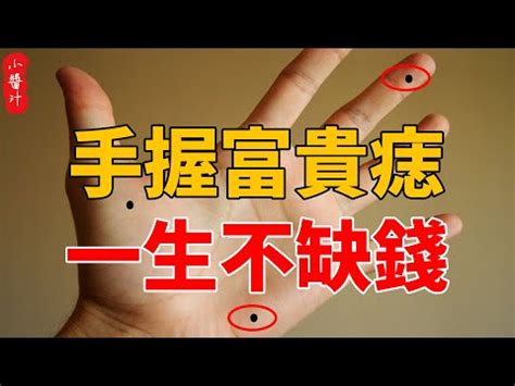 女人右手掌突然長痣|手相專家：掌痣暗示何事？